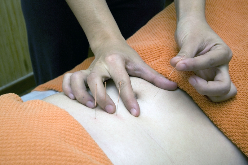 osteopathe-SOSPEL-min_acupuncture-4175625